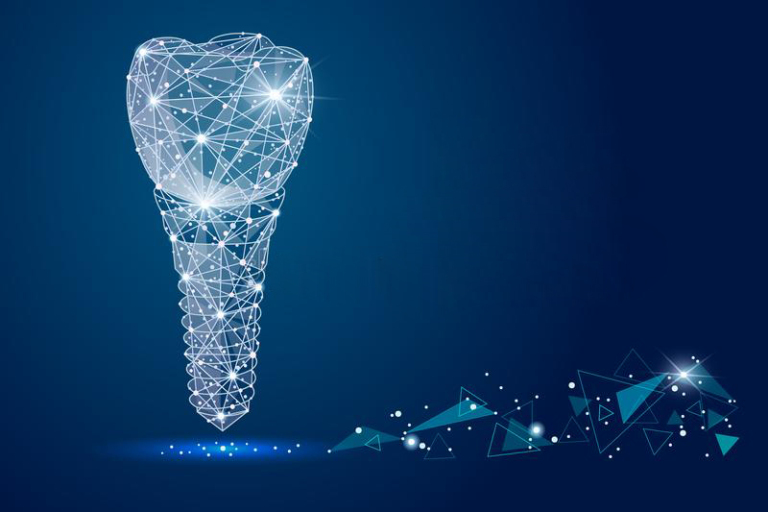 بهترین برند ایمپلنت